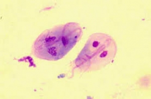 La Giardia: cos&#039;è e come si cura